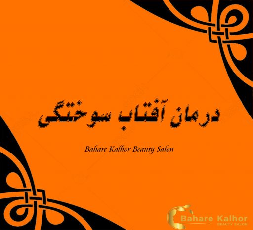 درمان آفتاب سوختگی