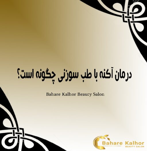 درمان آکنه با طب سوزنی چگونه است؟